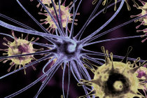 Exposição a vírus foi associada à demência subsequente e a outras doenças neurodegenerativas