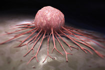 Terapia para câncer ósseo inesperadamente torna tumores menos dolorosos Terapia para câncer ósseo inesperadamente torna tumores menos dolorosos