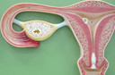 Anticorpos contra Chlamydia trachomatis associados ao dobro do risco para câncer de ovário, publicado pelo Journal of the National Cancer Institute Anticorpos contra Chlamydia trachomatis associados ao dobro do risco para câncer de ovário, publicado pelo Journal of the National Cancer Institute