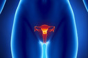 É possível acompanhar com ultrassonografias massas ovarianas com morfologia benigna, segundo estudo publicado pelo The Lancet Oncology É possível acompanhar com ultrassonografias massas ovarianas com morfologia benigna, segundo estudo publicado pelo The Lancet Oncology