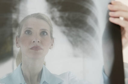 Daptomicina: FDA alerta para risco de pneumonia eosinof&iacute;lica com o uso desta medica&ccedil;&atilde;o