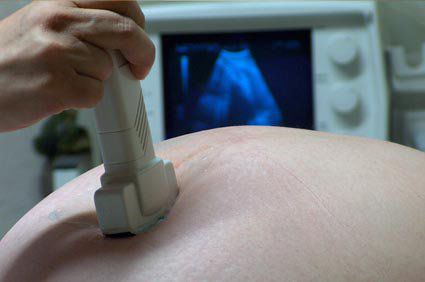 Descobertas preliminares não sinalizaram problemas de segurança da vacina de mRNA contra a Covid-19 em grávidas