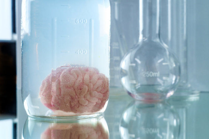 Exposi&ccedil;&atilde;o ocupacional ao formalde&iacute;do foi relacionada ao comprometimento cognitivo