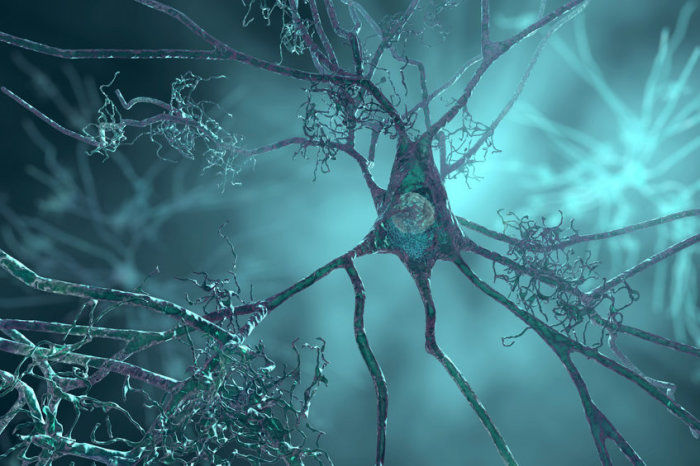 Grande parcela de casos de Alzheimer e dem&ecirc;ncia foram associados a 8 fatores de risco modific&aacute;veis