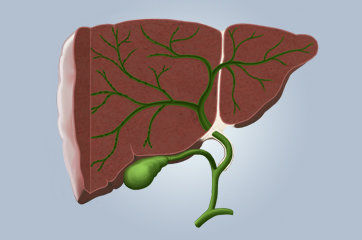 Incidência de carcinoma hepatocelular em pacientes com cirrose associada ao vírus da hepatite C tratada com agentes antivirais de ação direta