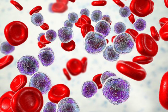 Inibição da proteína menina parece promissora na leucemia