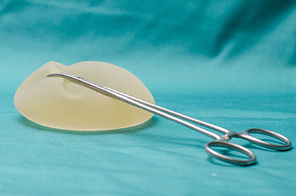 Mais casos de implantes mamários foram associados ao linfoma anaplásico de grandes células (BIA-ALCL)