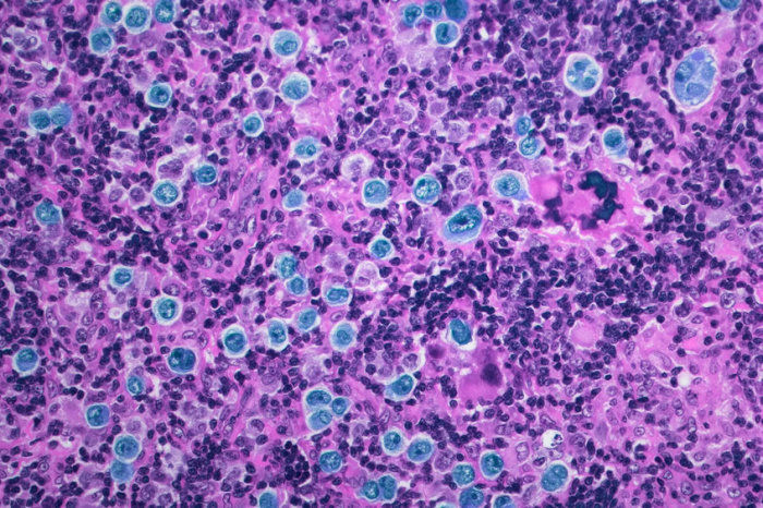 Pesquisadores criam nova molécula capaz de ativar as vias de morte celular em células cancerígenas