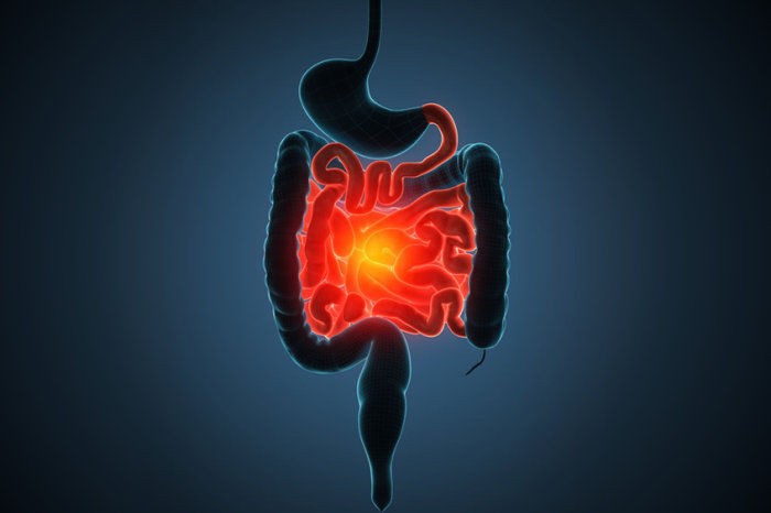 Risanquizumabe alivia a doen&ccedil;a de Crohn moderada a grave
