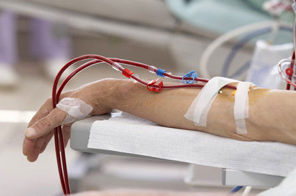 Suplementação de ferro associada à redução de 15% na mortalidade de doentes renais crônicos recebendo agentes estimulantes da eritropoiese