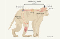 <i>Nature</i>: macacos com lesão na medula espinhal voltam a andar com um dispositivo cérebro-vertebral sem fio