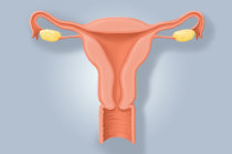 A endometriose pode ser causada por infecções bacterianas