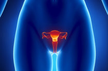 A endometriose pode ser causada por infecções bacterianas