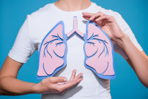 A segunda incidência de câncer de pulmão está aumentando rapidamente em mulheres