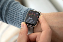 Apple Watch aumenta os diagnósticos de fibrilação atrial em pacientes de alto risco Apple Watch aumenta os diagnósticos de fibrilação atrial em pacientes de alto risco