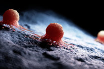Camada de queratina das células cancerígenas as protege contra as células do sistema imunológico