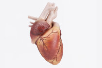 Cardiopatia atrial foi associada a risco 35% maior de demência