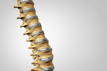 Célula-tronco que contribui para a formação de vértebras também estimula o crescimento de metástases na coluna vertebral