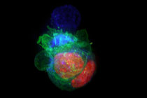 Células cancerígenas se escondem dentro de outras células cancerígenas para escapar do sistema imunológico