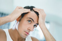 Descoberta de gene relacionado à queda de cabelos pode ajudar no desenvolvimento de medicamentos para tratar a calvície