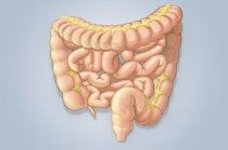 Dieta para doença inflamatória intestinal ativa mostra benefícios em um pequeno estudo publicado pelo <i>Journal of Clinical Gastroenterology</i>