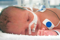 Dois modos de ventilação não invasiva se mostraram melhores opções para recém-nascidos com maior risco na UTIN