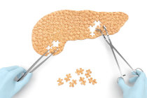 Esperança para o diabetes: células editadas por CRISPR liberaram insulina em uma pessoa e escaparam da detecção imunológica