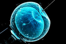 Estudo sobre como os genes influenciam a menopausa pode melhorar os tratamentos de fertilidade