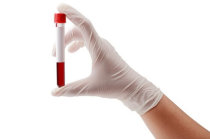 Exame de sangue diagnosticou com precisão a doença celíaca em adultos