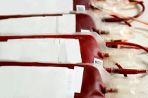 Existe transmissão de doenças neurodegenerativas por transfusão de sangue?
