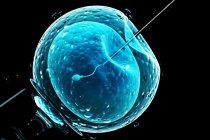 Fertilização <i>in vitro</i> usando DNA de três pessoas evitou que os bebês nascidos herdassem doenças genéticas graves