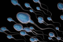Gel vaginal bloqueador de esperma pode ser um método contraceptivo confiável