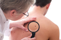 Maioria dos melanomas aparece como lesão primária, e não secundária a nevos pré-existentes, artigo do <i>Journal of the American Academy of Dermatology</i>