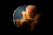 Organoides feitos de fluido uterino podem ajudar a tratar fetos antes do nascimento