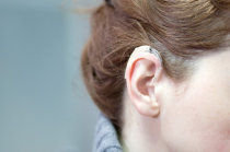Pigmentação da pele e risco de perda auditiva em mulheres