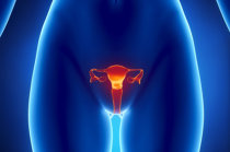 Rastreamento do câncer de ovário, utilizando o <i>Risk of Ovarian Cancer Algorithm (ROCA)</i>, identificou tumores incidentes em fase inicial e demonstrou alto valor preditivo positivo