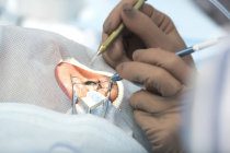 Terapia com células-tronco repara danos à córnea que eram considerados irreversíveis