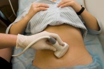 É possível acompanhar com ultrassonografias massas ovarianas com morfologia benigna, segundo estudo publicado pelo <i>The Lancet Oncology</i>