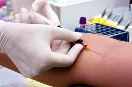 Exame de sangue distingue o Alzheimer de outras demências com alta precisão