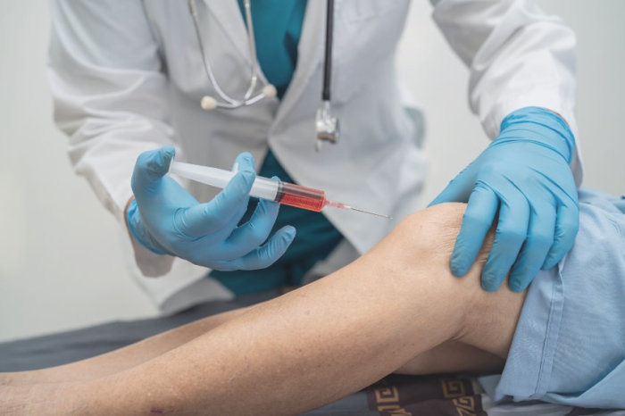 Injeções intra-articulares de ácido hialurônico não ajudam a osteoartrite do joelho mais do que placebo