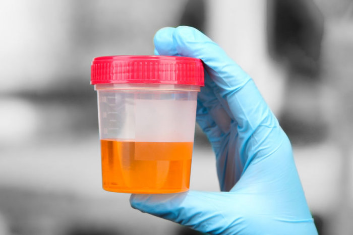 Medicamento antisséptico se mostrou tão bom quanto antibióticos para prevenir infecções do trato urinário recorrentes
