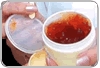 Gel feito com o sangue do próprio paciente acelera cicatrização de ferimentos