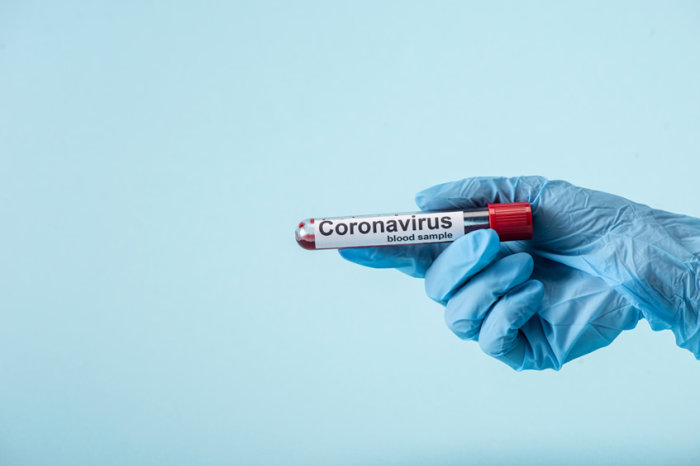 Precisão diagnóstica dos testes sorológicos para covid-19