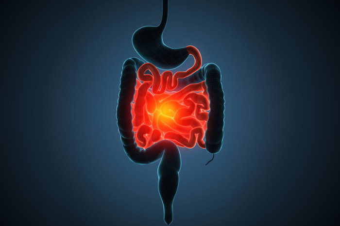 Risanquizumabe alivia a doença de Crohn moderada a grave