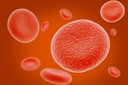 NEJM: uso de transfusões de sangue regulares na prevenção de infartos cerebrais em crianças com anemia falciforme