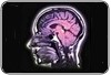 Estimulação elétrica cerebral pode melhorar o desempenho em testes de memória