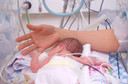 Cirurgia que requer anestesia geral em bebês prematuros está associada a piores resultados do desenvolvimento cerebral