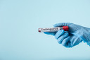 DETECTR: uma nova forma de detecção rápida, sensível e específica do novo coronavírus SARS-CoV-2 baseada em CRISPR