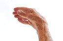 Estudo demonstra altas taxas de remissão na artrite reumatoide inicial tanto com tratamento convencional ativo quanto com três tratamentos biológicos diferentes