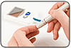 Anemia deve ser pesquisada precocemente em diabéticos, segundo artigo publicado na Diabetes Research and Clinical Practice